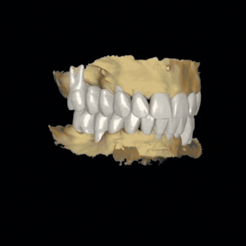Diseño Digital Dental